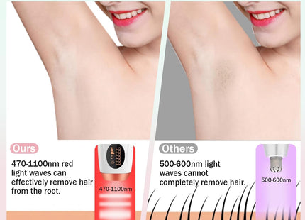 IPL Photon Rejuvenation Hair Removal Device – 999,999 Flashes