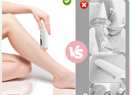 IPL Photon Rejuvenation Hair Removal Device – 999,999 Flashes
